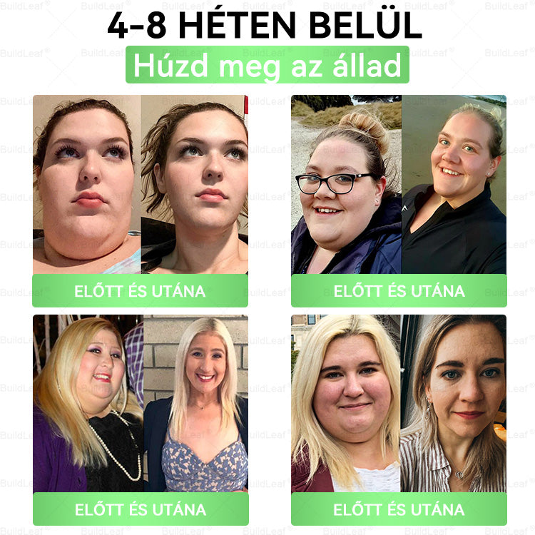 🍃Hivatalos áruház | BuildLeaf GLP-1 20 az 1-ben Karcsúsító és egészséges szájon át szedhető folyadék (naponta egyszer, 7 napon belül hat) ✅ Támogatja a testsúlyt és a nők egészségét, miközben feszesíti a bőrt és fokozza a vitalitást